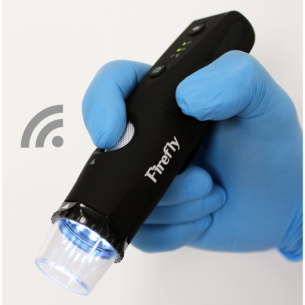 Dermatoscop digital wireless