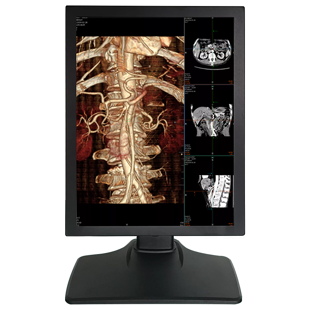 Monitor Medical 21.3inch 2MP Color