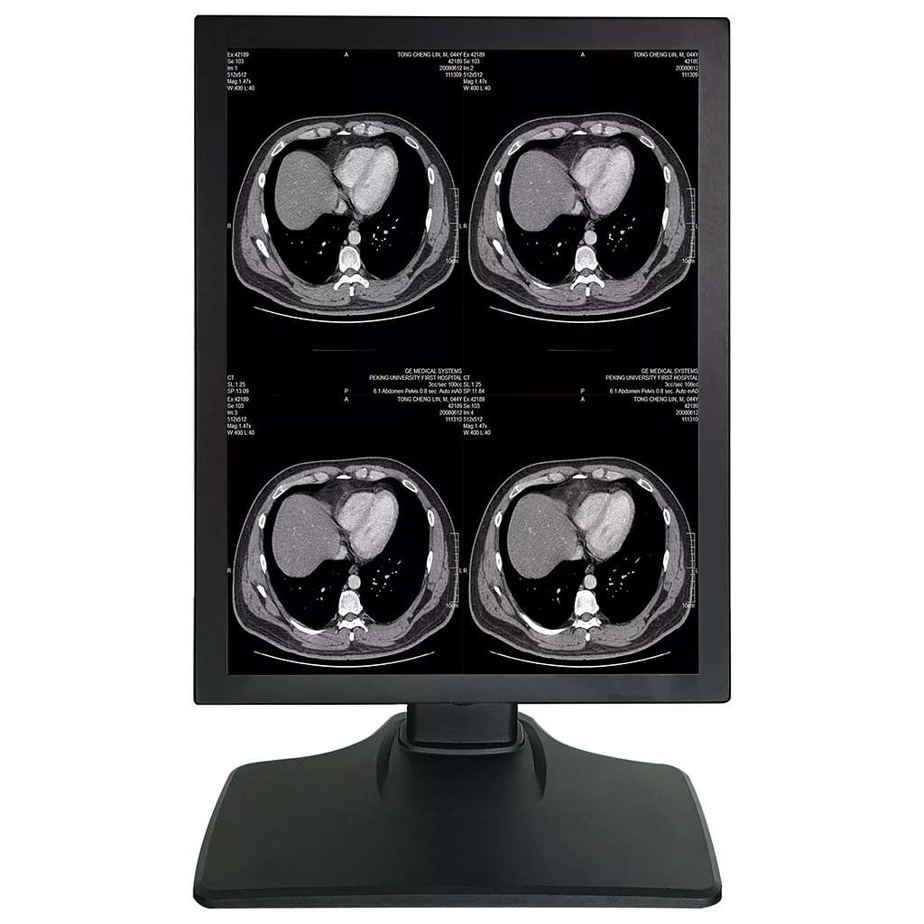 Monitor Medical 21.3inch 2MP Gri