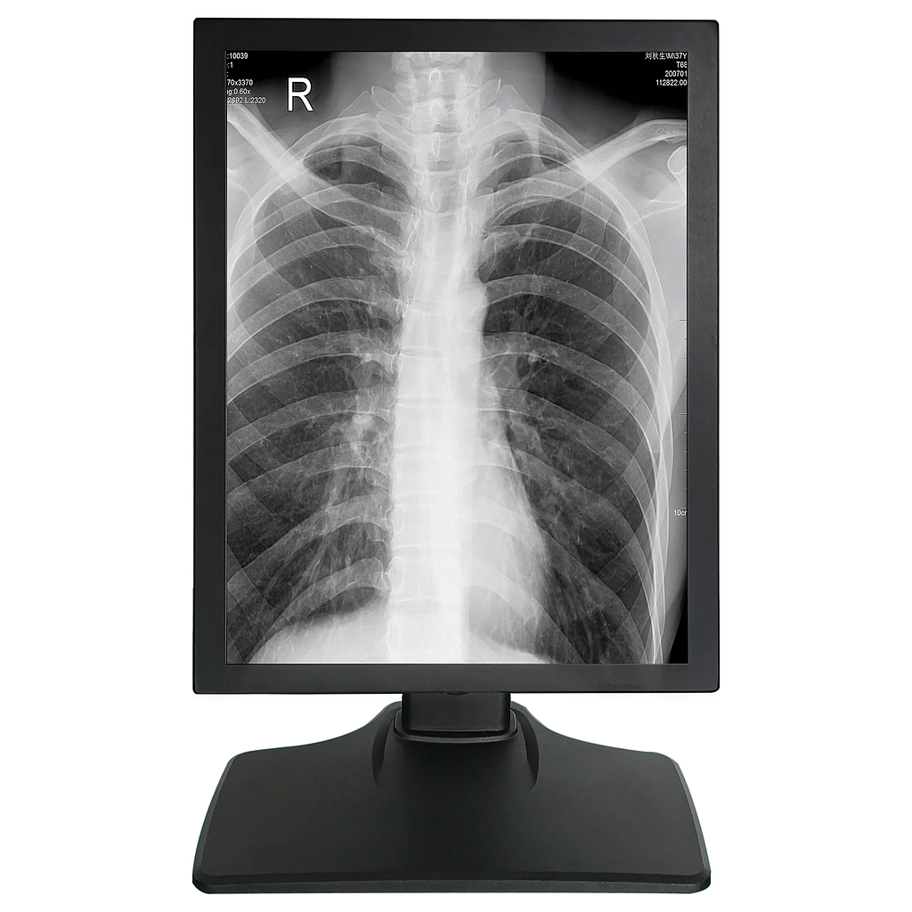 Monitor Medical 21.3inch 3MP Gri