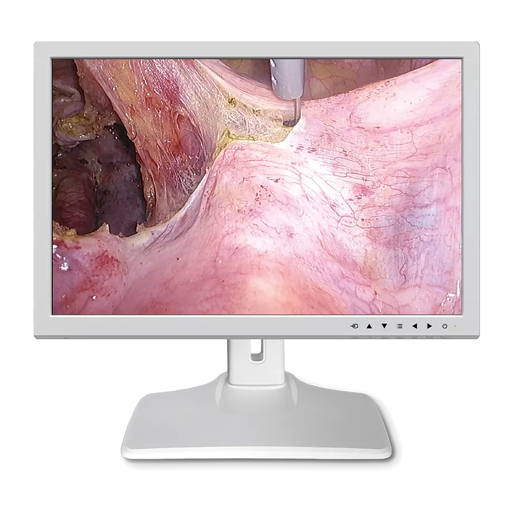 Monitor Medical 24inch HD