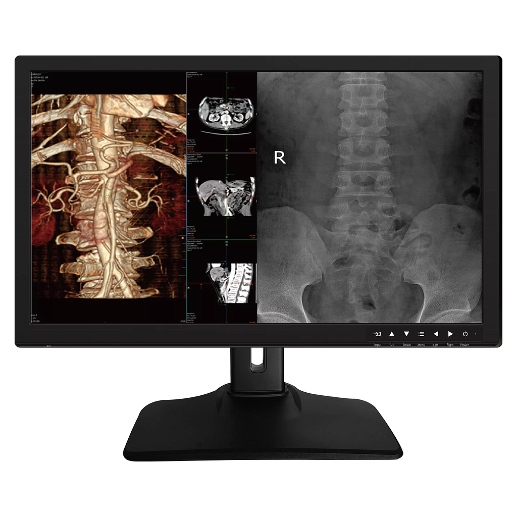 Monitor Medical 27inch 4MP Color