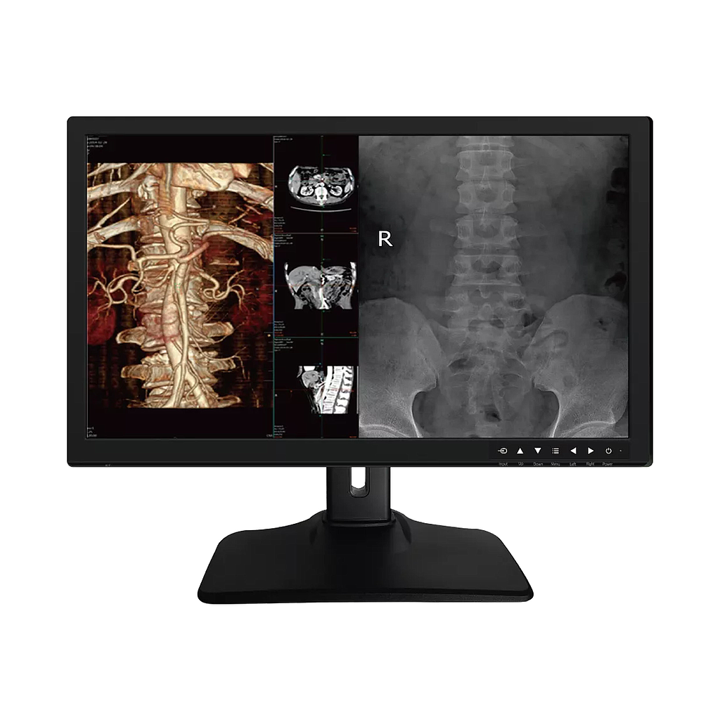 Monitor Medical 27inch 8MP Color