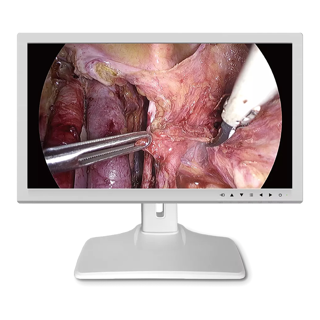 Monitor Medical 27inch HD