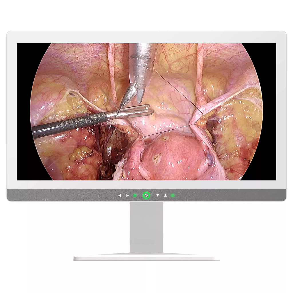 Monitor Medical 32inch 4K