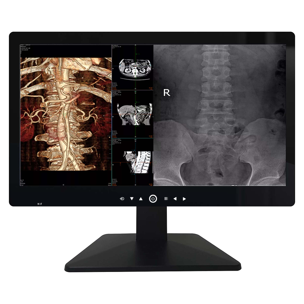 Monitor Medical 32inch 8MP Color