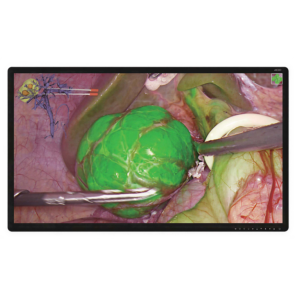 Monitor Medical 43inch 4K 3D MiniLED