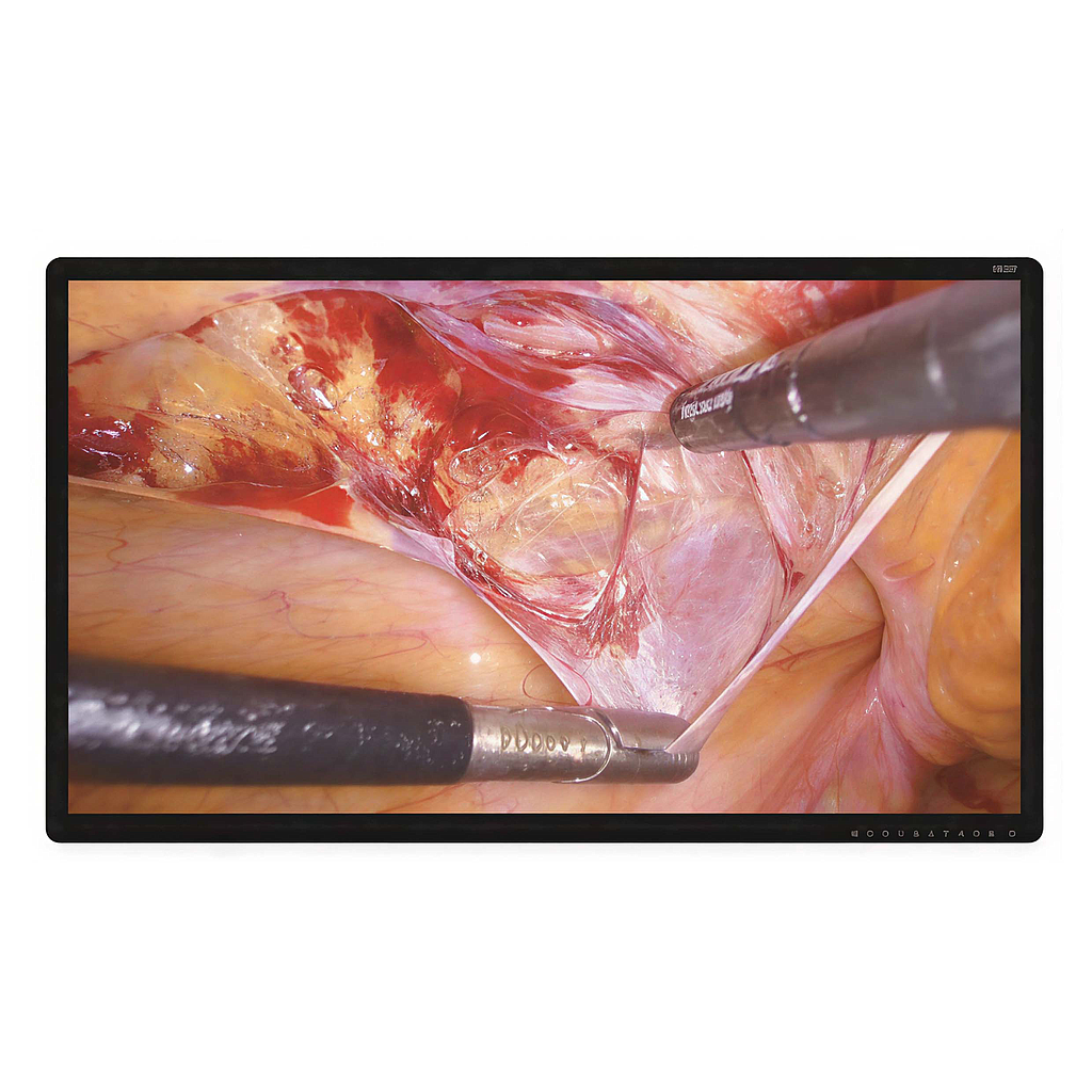 Monitor Medical 43inch 4K MiniLED