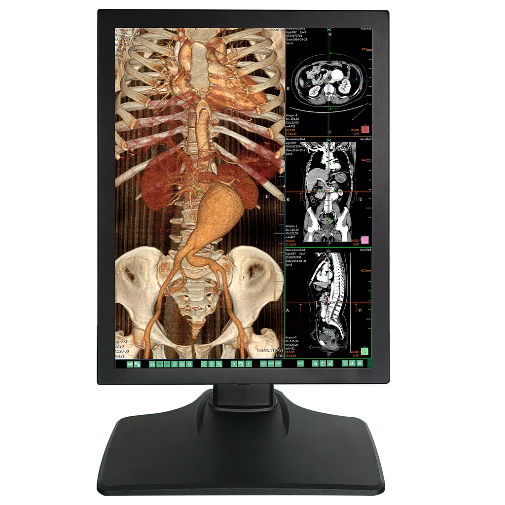Monitor Medical 21.3inch 3MP Color